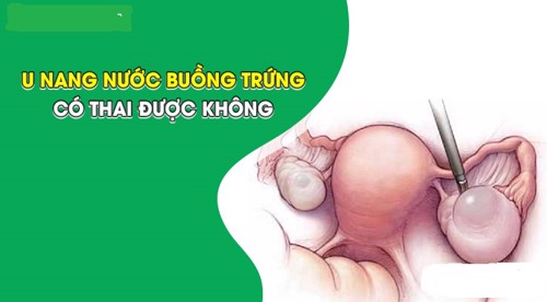 U nang nước buồng trứng có thai được không? Câu trả lời có tại đây 